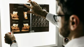 Pljačka ili pljaćka: Kako pravilno pisati i razlikovati suglasnike č i ć